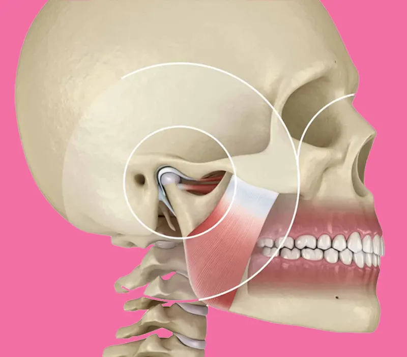 Gnatologia treviso studio dentistico stancati gestido