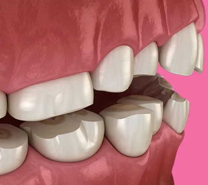 Odontoiatria Mio fasciale Treviso - Biban Di Carbonera - Studio Gestido Stancati Odontoiatria Mio fasciale Treviso - Biban Di Carbonera - Studio Gestido Stancati