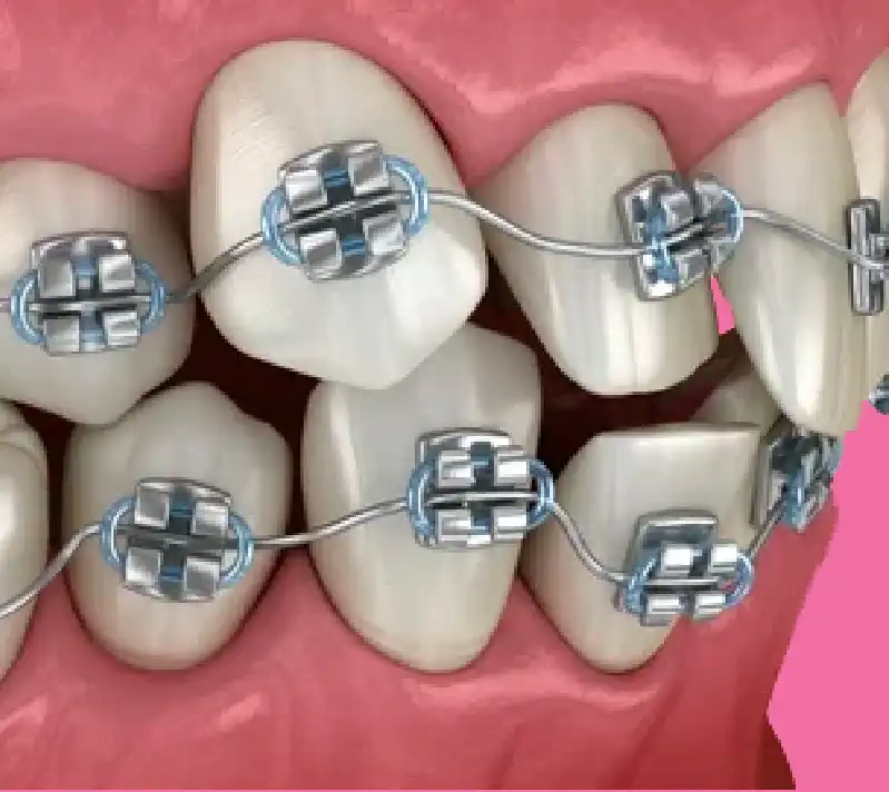 odontoiatria treviso - biban di carbonera - studio Gestido Stancati odontoiatria treviso - biban di carbonera - studio Gestido Stancati