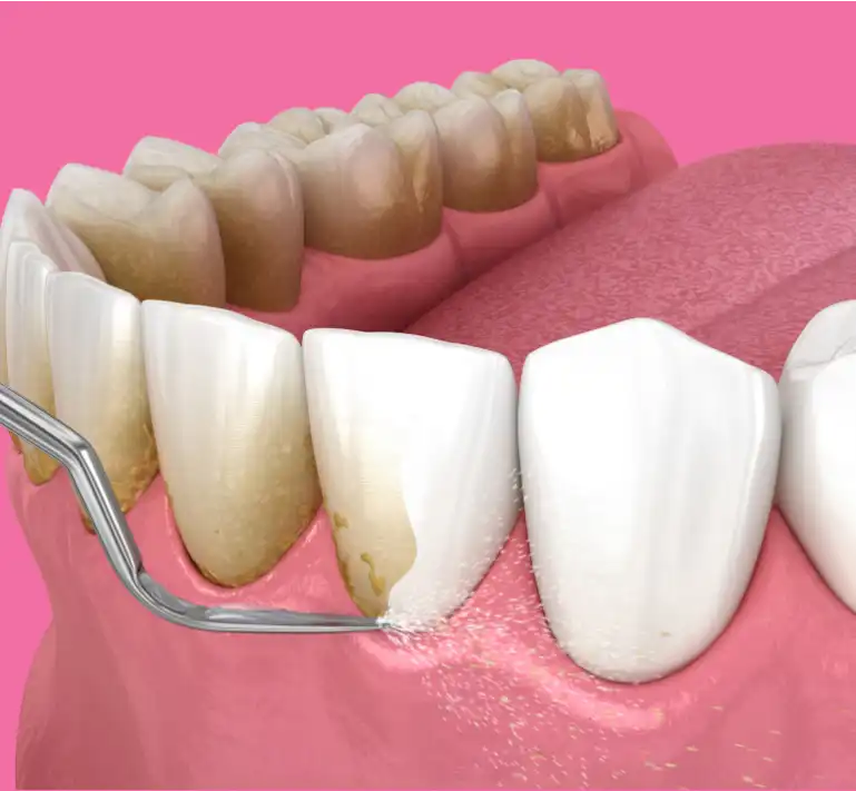 igiene orale treviso biban di carbonera studio dentistico igiene orale treviso biban di carbonera studio dentistico